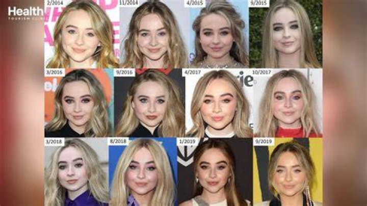 Unveiling The Truth: Sabrina Carpenter's Face Surgery Rumors