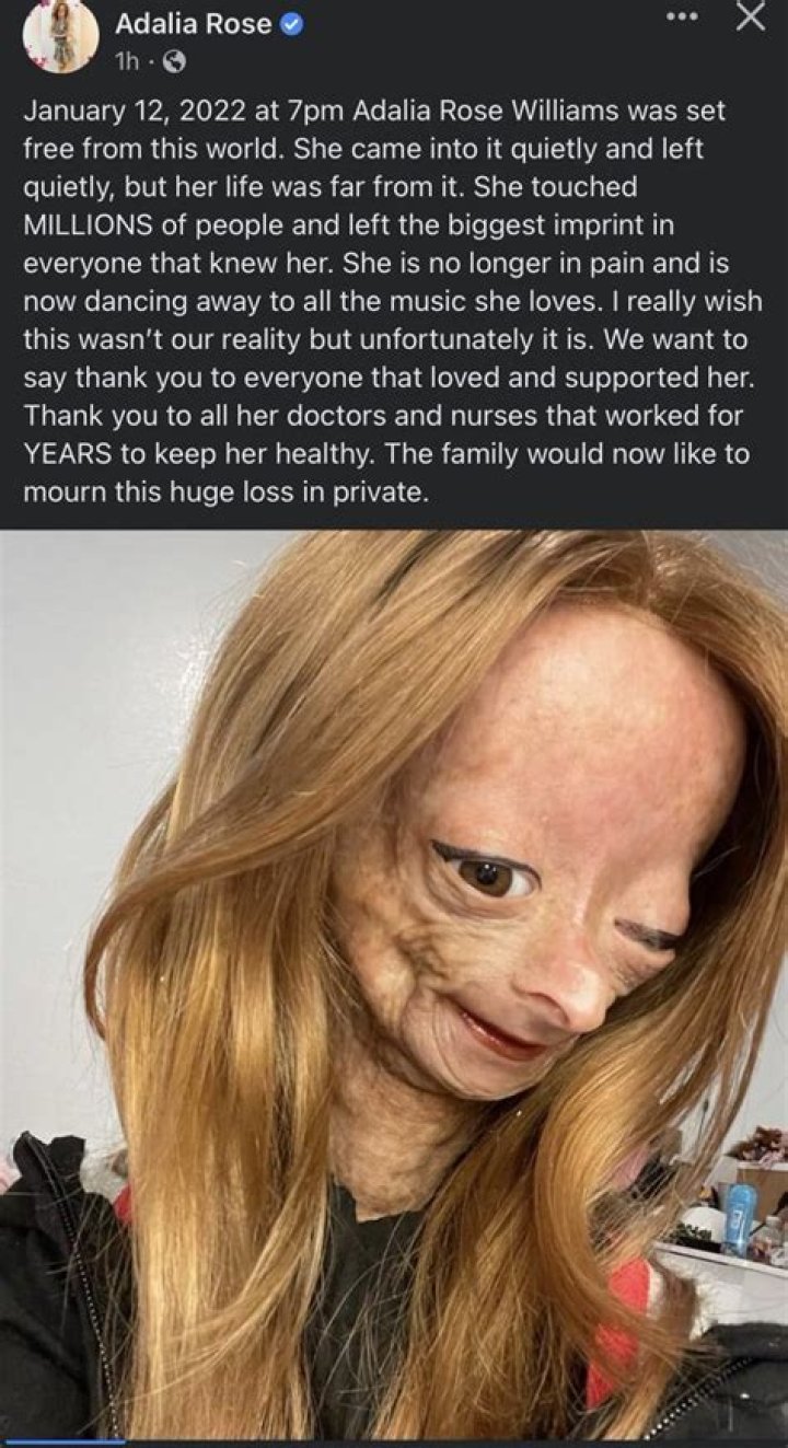 What Was Adalia Rose's Cause of Death? The Teen Influencer Passed Away