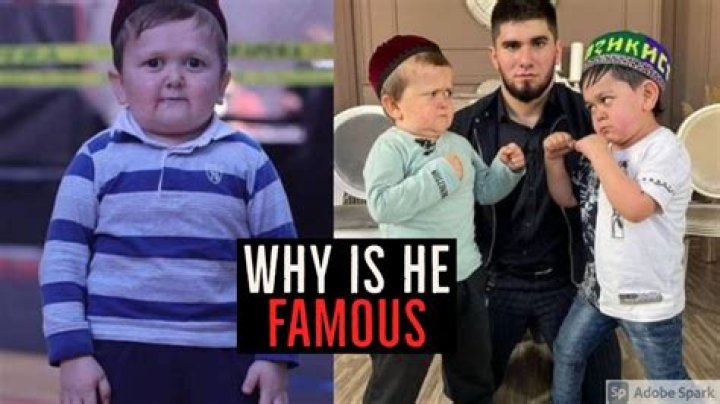 Why Is Hasbulla Magomedov Famous? His Real Age and Condition Explained