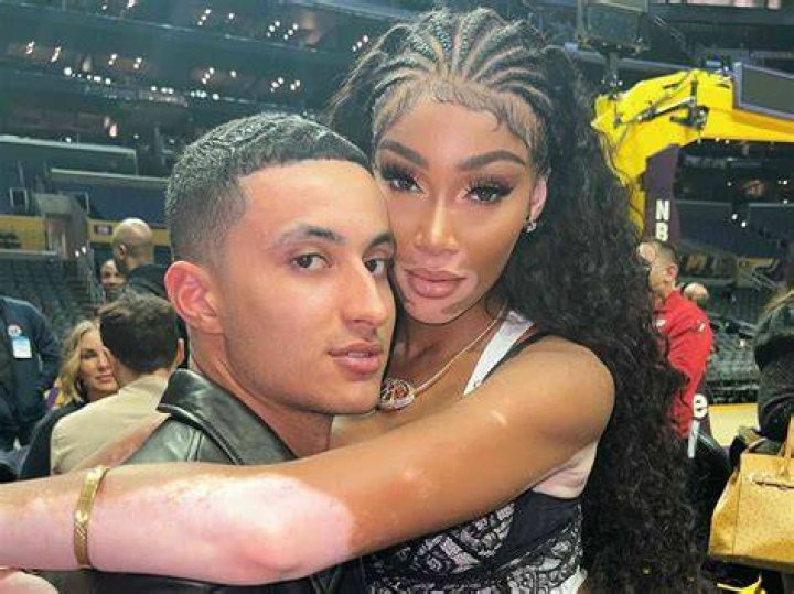 Winnie Harlow And Kyle Kuzma Are Back Together 5 Months After Split