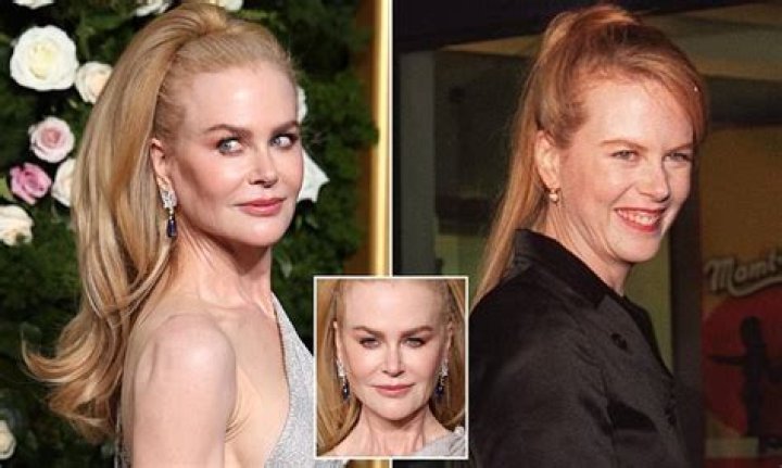 Woman, 54, Looks Like Nicole Kidman After Getting Surgery