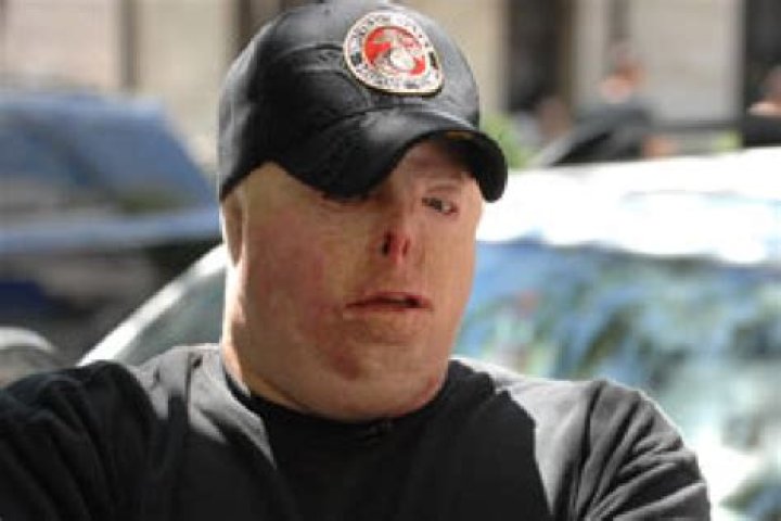 Wounded vets lobby for recognition POLITICO