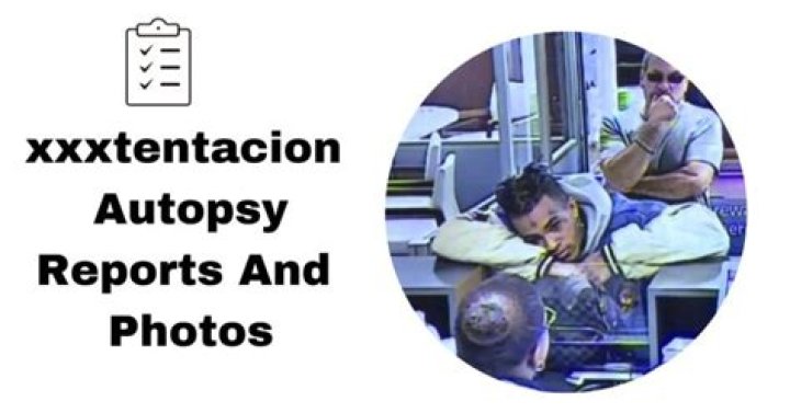 Xxxtentacion Autopsy Photos Of King Von Autopsy Viral vrogue.co